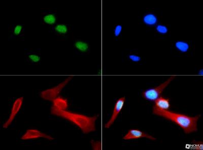 Immunocytochemistry/Immunofluorescence: Histone H4 [Monomethyl Arg3] Antibody [NB21-2011] - Histone H4 R3me1 antibody was tested at 1:50 in HeLa cells with FITC (green). Nuclei were counterstained with Dapi (blue).
